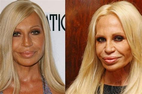 donatella versace antes y después|donatella versace.